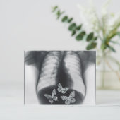 Röntgenfoto van vlinders in de maag briefkaart (Staand voorkant)