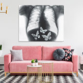 Röntgenfoto van vlinders in de maag canvas afdruk (Insitu (Woonkamer))