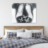 Röntgenfoto van vlinders in de maag canvas afdruk (Insitu (Slaapkamer))
