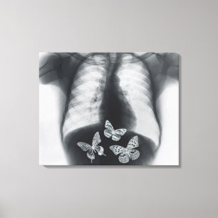 Röntgenfoto van vlinders in de maag canvas afdruk