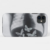 Röntgenfoto van vlinders in de maag Case-Mate iPhone case (Achterkant (horizontaal))