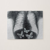 Röntgenfoto van vlinders in de maag legpuzzel (Horizontaal)