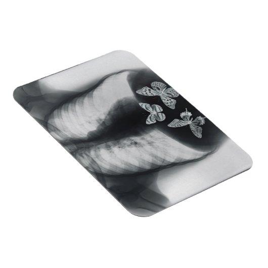 Röntgenfoto van vlinders in de maag magneet (Rechterzijde)