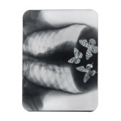 Röntgenfoto van vlinders in de maag magneet (Verticaal)