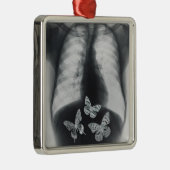 Röntgenfoto van vlinders in de maag metalen ornament (Rechts)