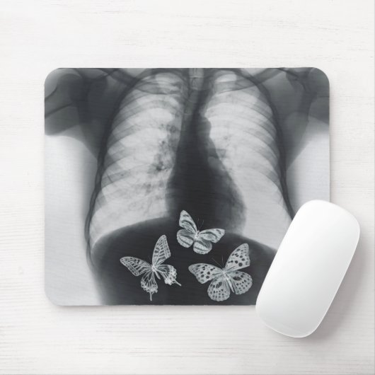 Röntgenfoto van vlinders in de maag muismat (Met muis)