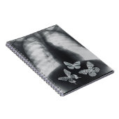 Röntgenfoto van vlinders in de maag notitieboek (Rechterzijde)