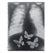 Röntgenfoto van vlinders in de maag notitieboek (Voorkant)