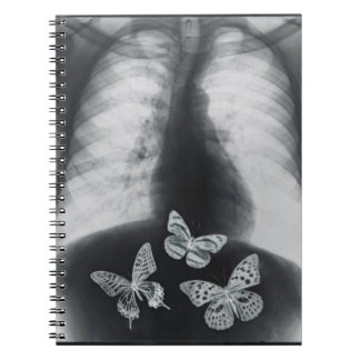 Röntgenfoto van vlinders in de maag notitieboek