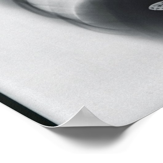 Röntgenfoto van vlinders in de maag poster (Hoek)