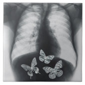 Röntgenfoto van vlinders in de maag tegeltje (Voorkant)