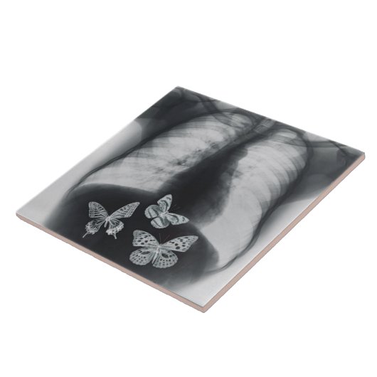 Röntgenfoto van vlinders in de maag tegeltje (Zijkant)