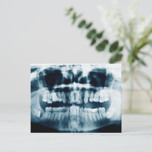 röntgenfoto's briefkaart (Staand voorkant)