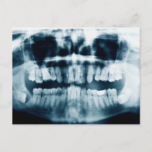 röntgenfoto's briefkaart (Voorkant)