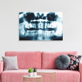 röntgenfoto's canvas afdruk (Insitu (Woonkamer))