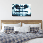 röntgenfoto's canvas afdruk (Insitu (Slaapkamer))