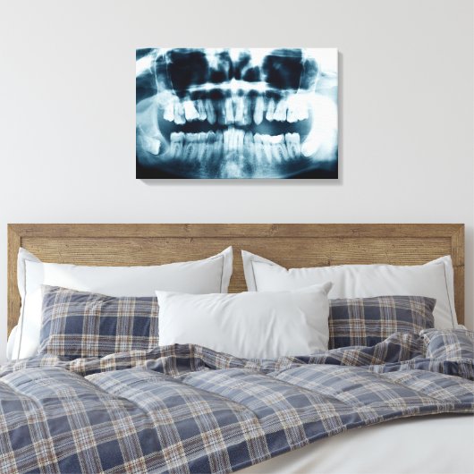 röntgenfoto's canvas afdruk (Insitu (Slaapkamer))