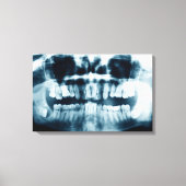 röntgenfoto's canvas afdruk (Voorkant)