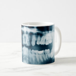röntgenfoto's koffiemok