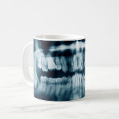 röntgenfoto's koffiemok (Voorkant links)