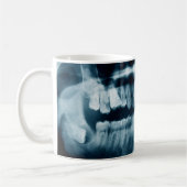 röntgenfoto's koffiemok (Links)