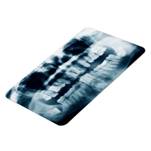 röntgenfoto's magneet (Linkerzijde)