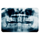 röntgenfoto's magneet (Horizontaal)