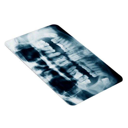 röntgenfoto's magneet (Rechterzijde)