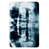 röntgenfoto's magneet (Verticaal)