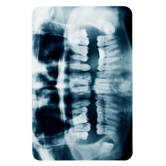 röntgenfoto's magneet (Verticaal)