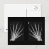 Röntgenfoto's met extra cijfers rechts en links briefkaart (Voorkant / Achterkant)