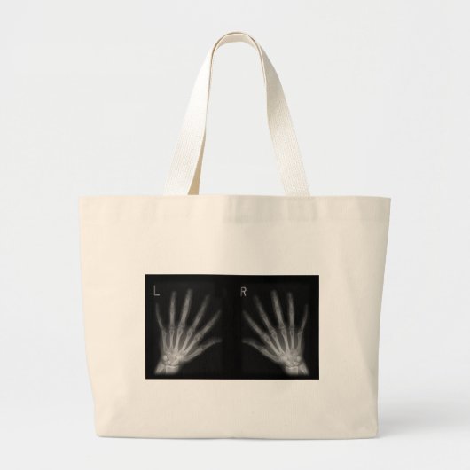 Röntgenfoto's met extra cijfers rechts en links grote tote bag (Voorkant)