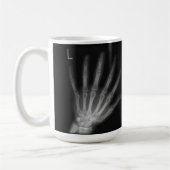 Röntgenfoto's met extra cijfers rechts en links koffiemok (Links)