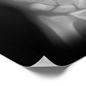 Röntgenfoto's met extra cijfers rechts en links poster (Hoek)