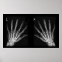 Röntgenfoto's met extra cijfers rechts en links