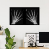 Röntgenfoto's met extra cijfers rechts en links poster (Thuiskantoor)