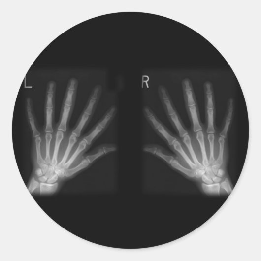 Röntgenfoto's met extra cijfers rechts en links ronde sticker (Voorkant)