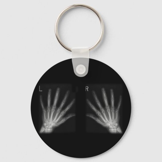 Röntgenfoto's met extra cijfers rechts en links sleutelhanger (Voorkant)