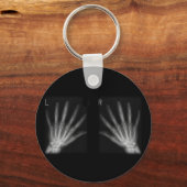 Röntgenfoto's met extra cijfers rechts en links sleutelhanger (Voorkant)