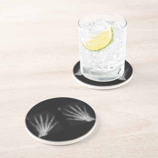 Röntgenfoto's met extra cijfers rechts en links zandsteen onderzetter (Zijkant)