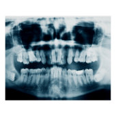 röntgenfoto's perfect poster (Voorkant)