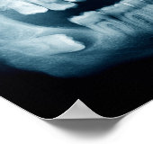 röntgenfoto's poster (Hoek)