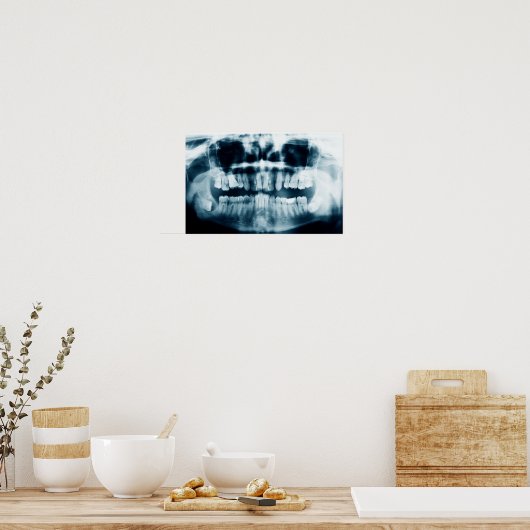 röntgenfoto's poster (Keuken)