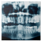 röntgenfoto's tegeltje (Voorkant)