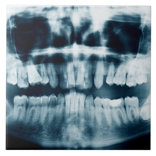 röntgenfoto's tegeltje (Voorkant)