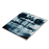 röntgenfoto's tegeltje (Zijkant)