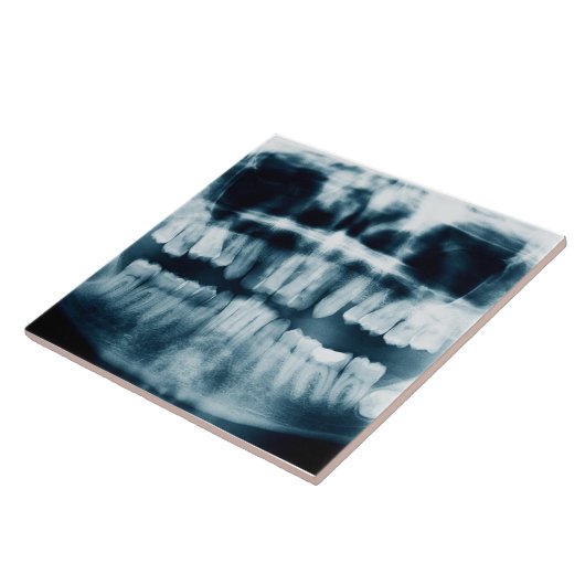 röntgenfoto's tegeltje (Zijkant)