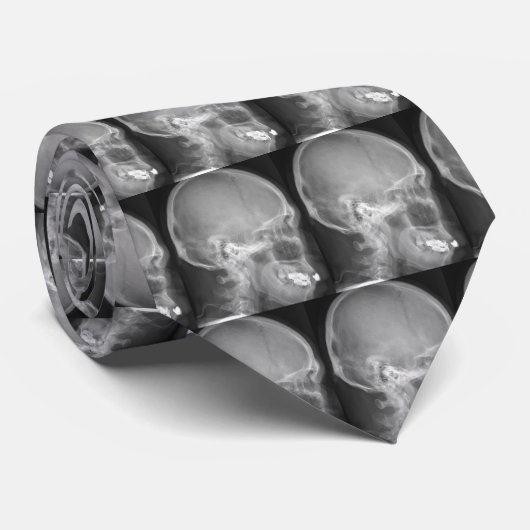 Röntgenfoto's van de schedel stropdas (Opgerold)