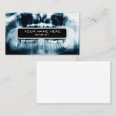 röntgenfoto's visitekaartje (Voorkant / Achterkant)