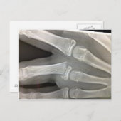 röntgengebroken bot wordt snel goed briefkaart (Voorkant / Achterkant)